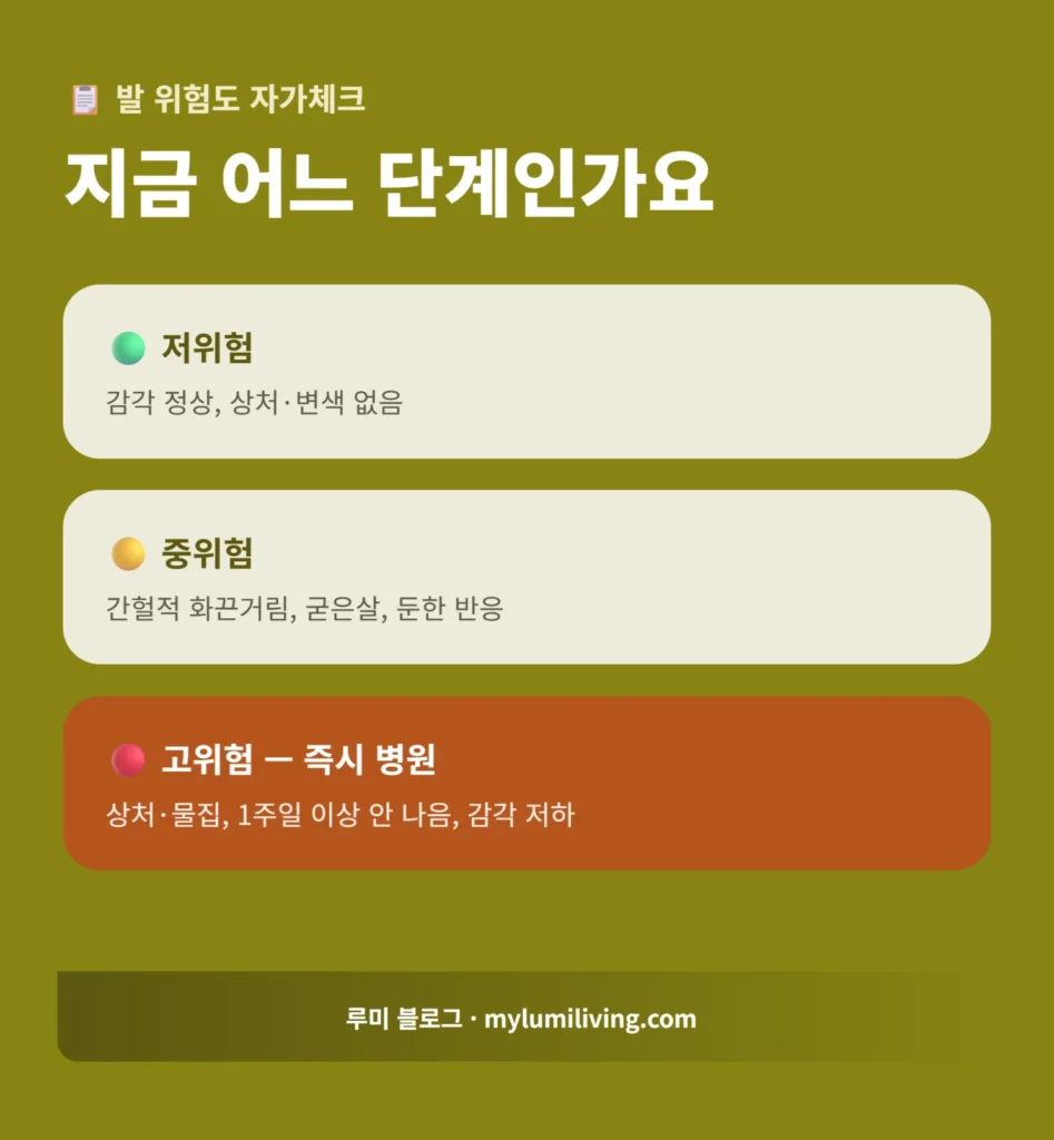 발 위험도 자가체크 인포그래픽
