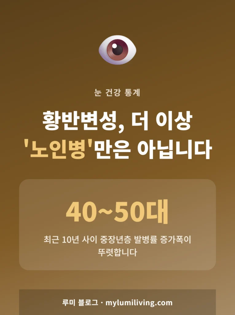 황반변성 발병 연령이 낮아지는 추세를 보여주는 인포그래픽