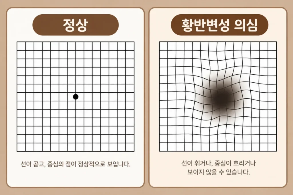 정상 격자와 휘어 보이는 암슬러 격자 비교 일러스트