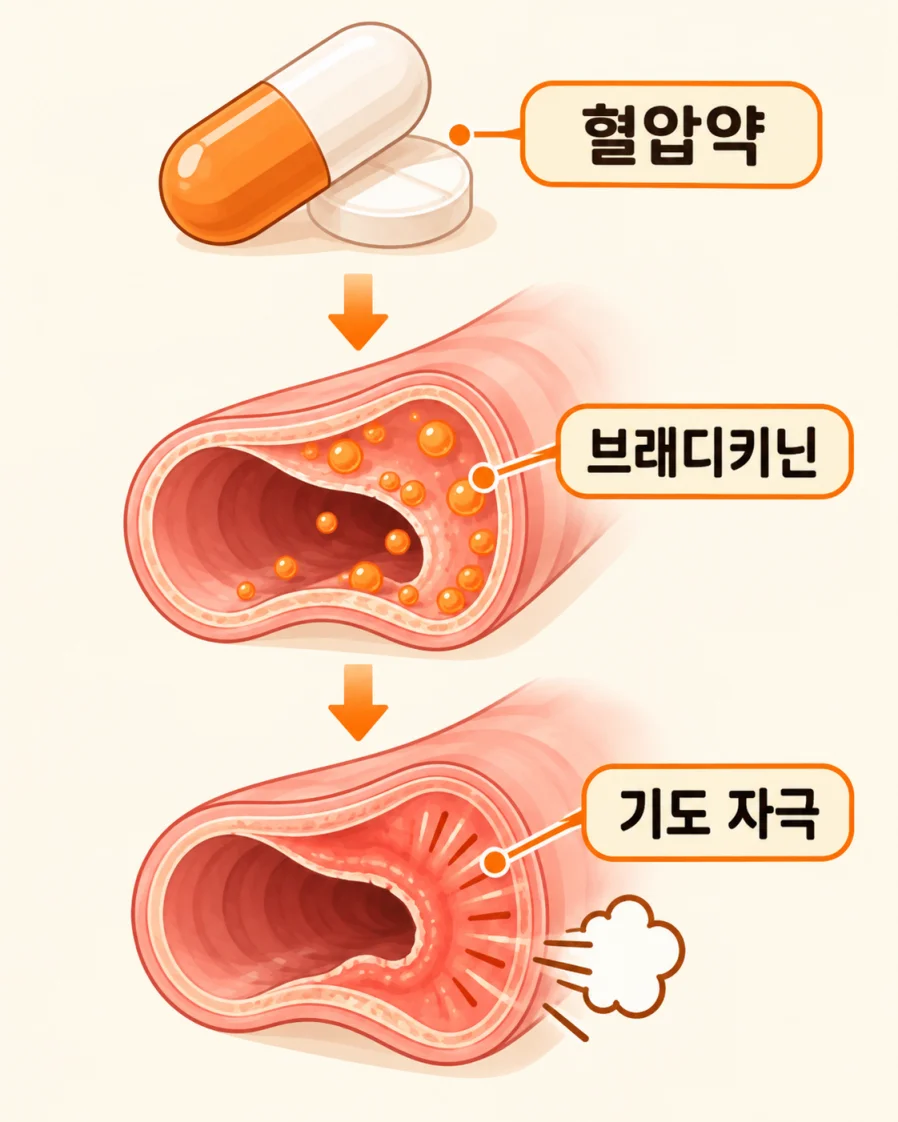 고혈압약 ACE 억제제가 브래디키닌을 쌓이게 해 마른기침을 일으키는 과정 의학 일러스트